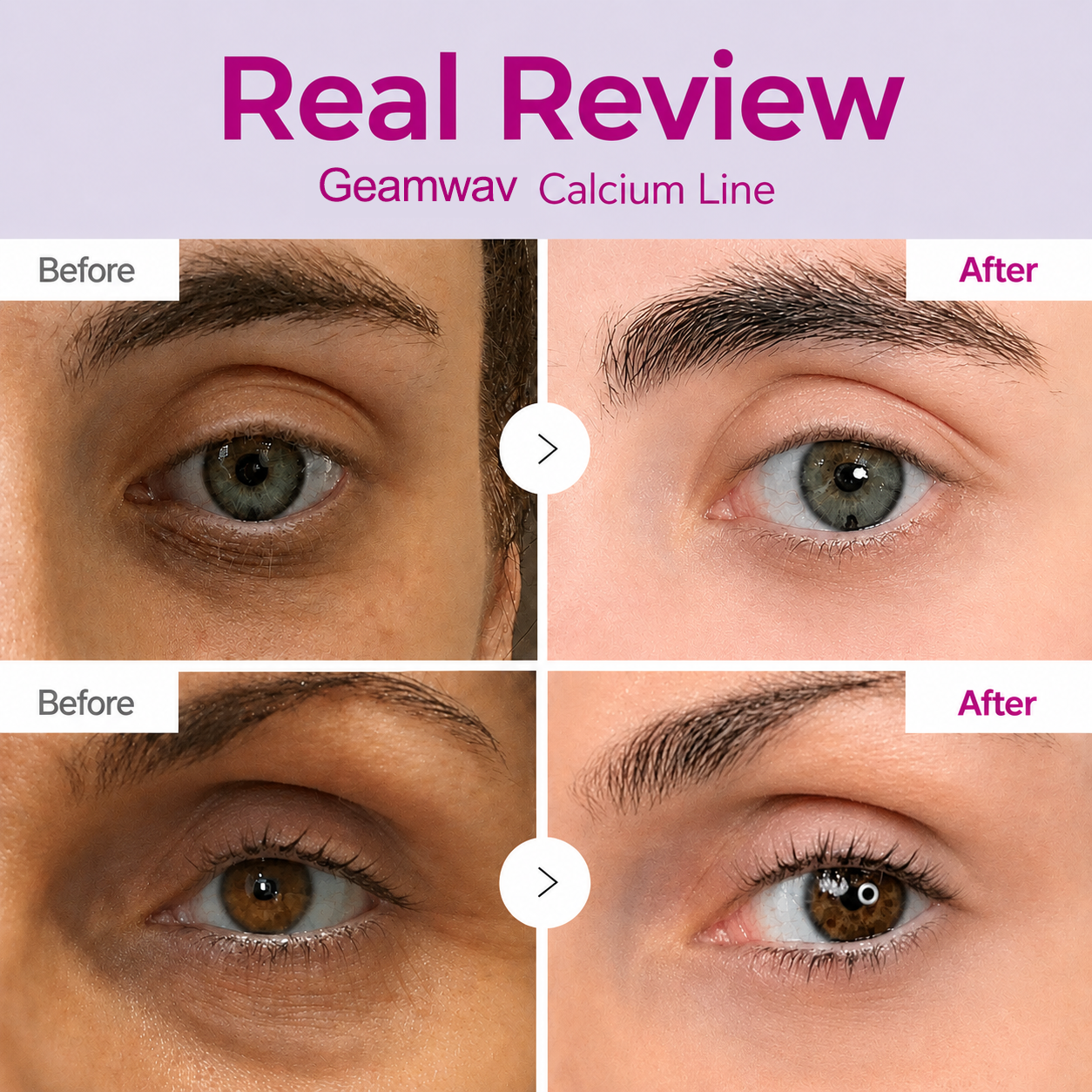 🔥LAST DAY 50% OFF!!Geamwav Korean Calcium Dark Spot Eye Cream
